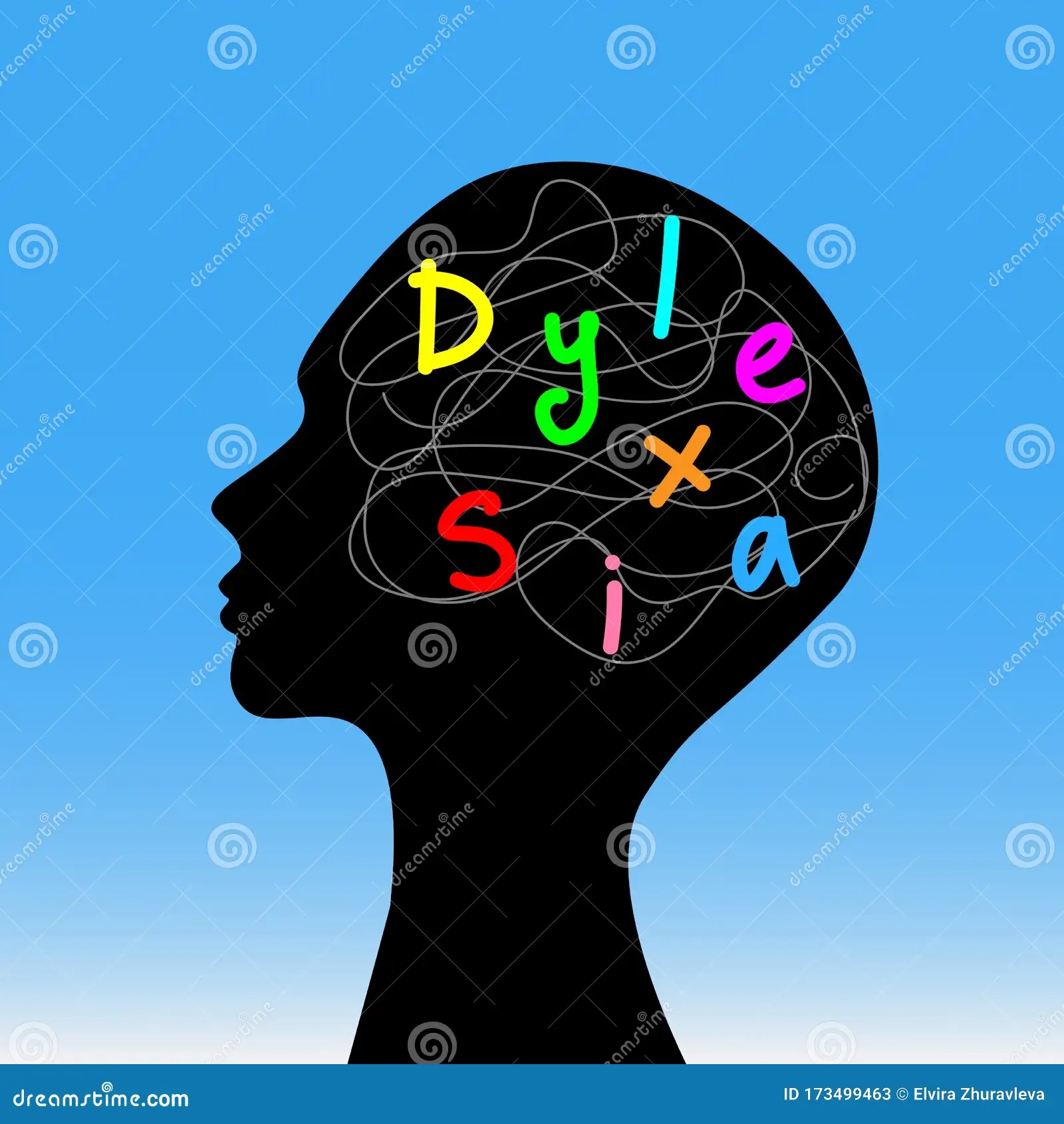 Mind Of A Dyslexic Person Is Confused About Letters Stock Vector Illustration Of Dyscalculia Child 173499463