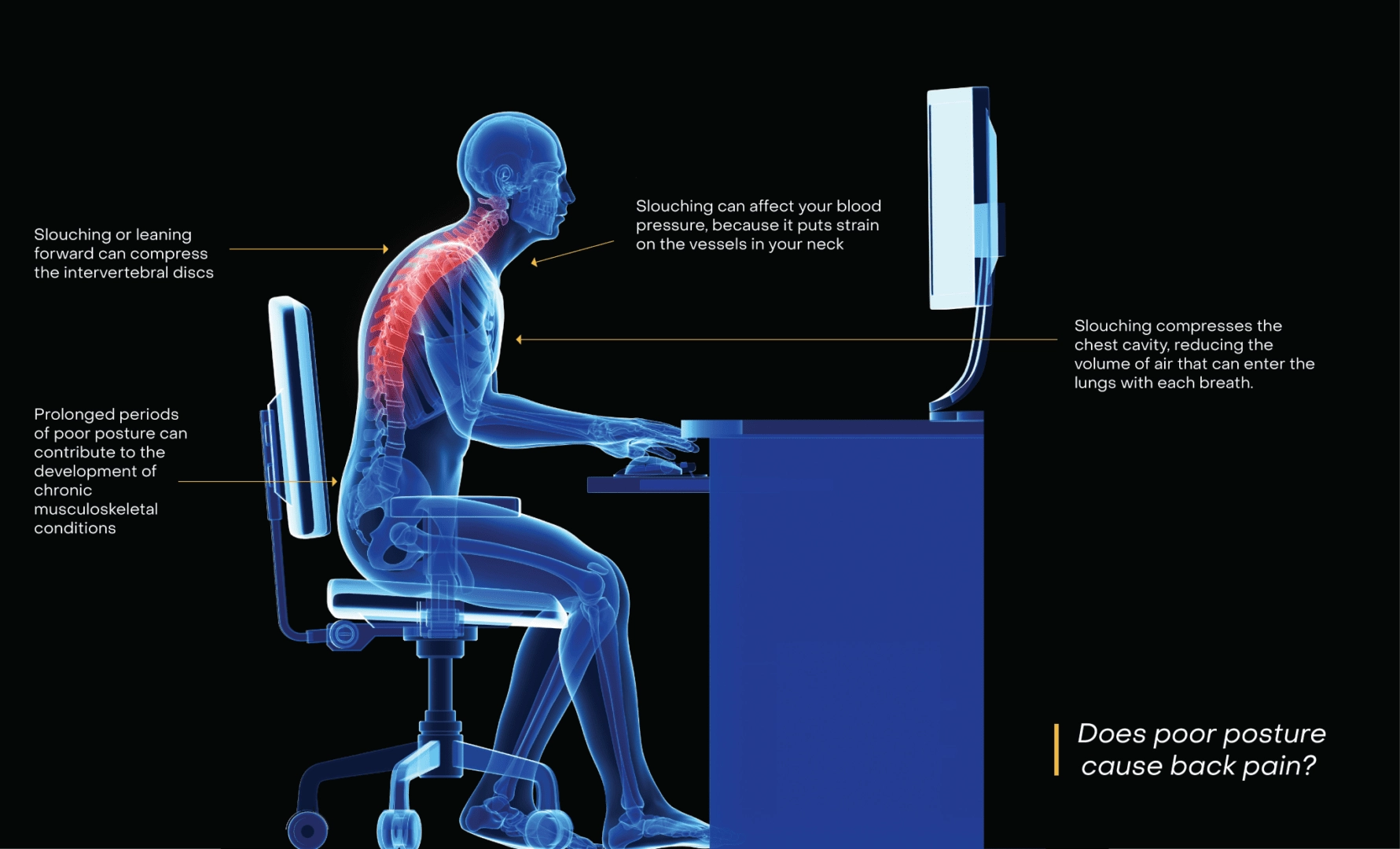 Spine Health Posture And Workplace Ergonomics National Spine Health Foundation Spine Health Posture And Workplace Ergonomics National Spine Health Foundation